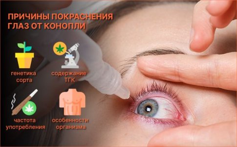 Причины красных глаз от марихуаны